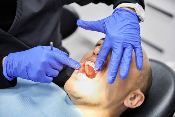 Best Knocked-Out Tooth Emergency  in Winchester, CA
